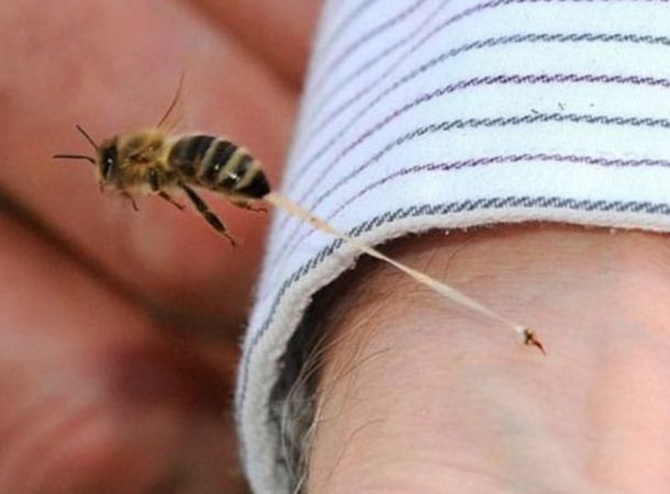 Τσίμπημα από μέλισσα/σφήκα