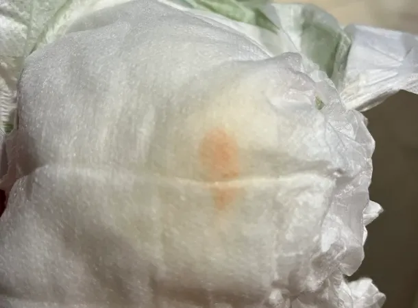 "Κόκκινα" ούρα στην πάνα