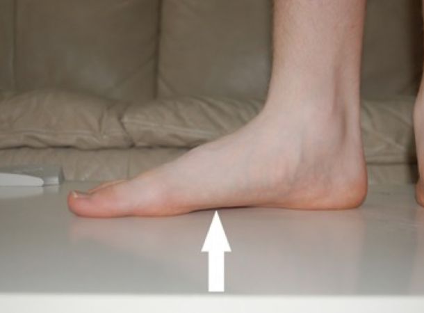 Πλατυποδία στα νήπια